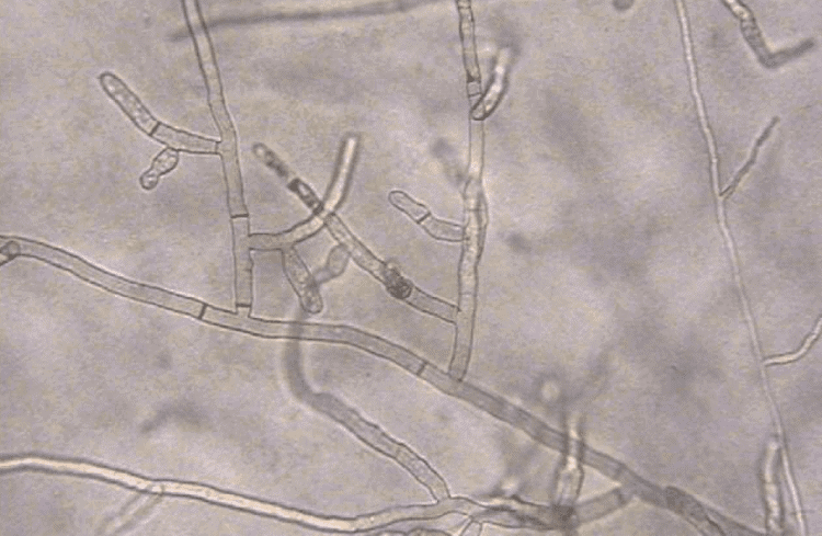 How to Fix a Brown Patch in Your Lawn: 6 Steps 3 Rhizoctonia Fungus